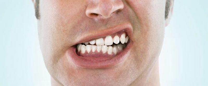 Imploodonto - Bruxismo é uma desordem funcional que se caracteriza pelo  ranger ou apertar dos dentes durante o sono. Essa pressão pode provocar  desgaste e amolecimento dos dentes. Nos casos mais graves